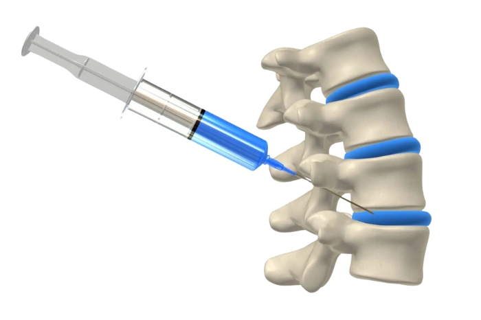 Facet Joint Injection Procedure Omaha, NE